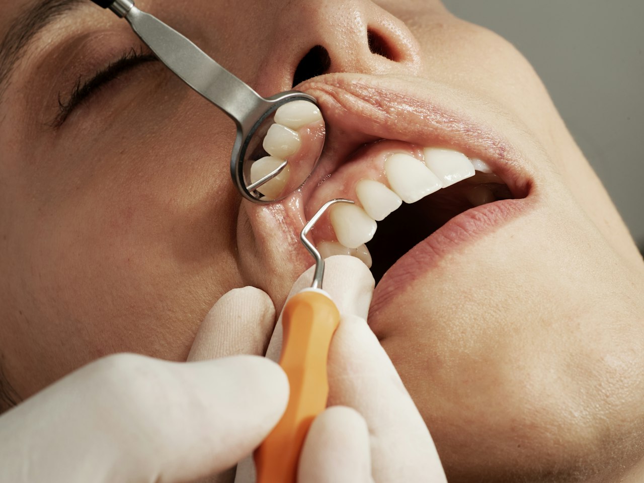 Dental exam with mirror and dental tool